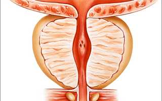 Увеличение простаты: причины, симптомы и народные способы лечения