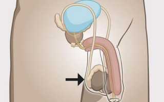 Мошонка: что это такое, строение, травмы и патологии