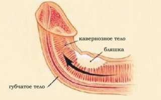 Кавернит: симптомы, причины и лечение