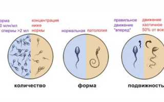 Как улучшить качество спермограммы