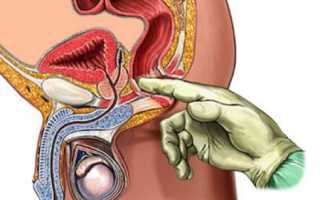 Массаж простаты в домашних условиях своими руками