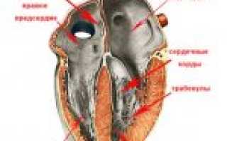 Ложная хорда левого желудочка сердца: как действовать