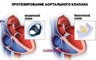 Давление 110 на 80: что это значит, нормально или нет и что делать