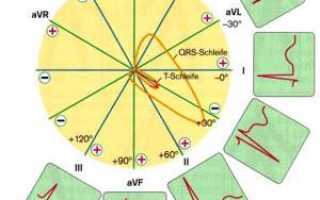 Электрокардиограмма: что это такое, кому назначают и как расшифровать